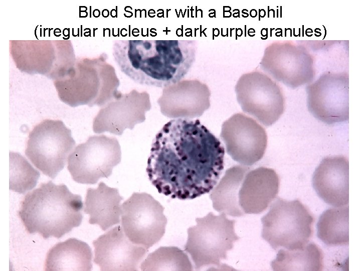 Blood Smear with a Basophil (irregular nucleus + dark purple granules) 