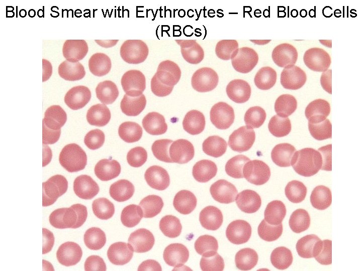 Blood Smear with Erythrocytes – Red Blood Cells (RBCs) 