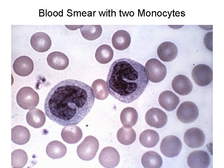 Blood Smear with two Monocytes 