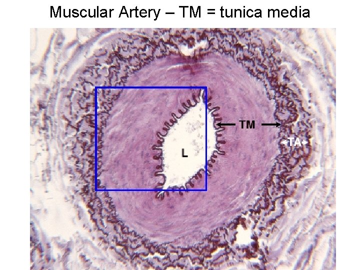 Muscular Artery – TM = tunica media 