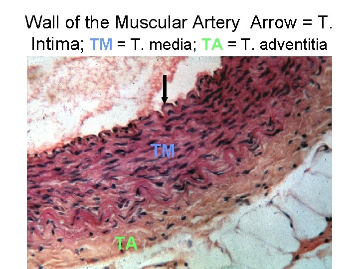 Wall of the Muscular Artery Arrow = T. Intima; TM = T. media; TA