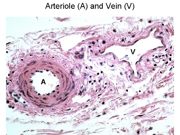 Arteriole (A) and Vein (V) V A 