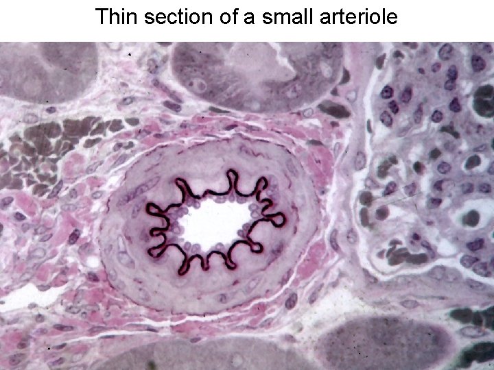 Thin section of a small arteriole 