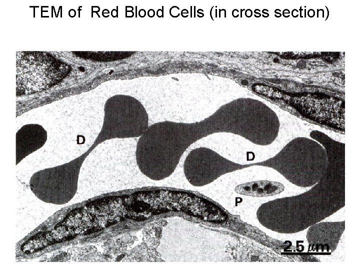 TEM of Red Blood Cells (in cross section) 