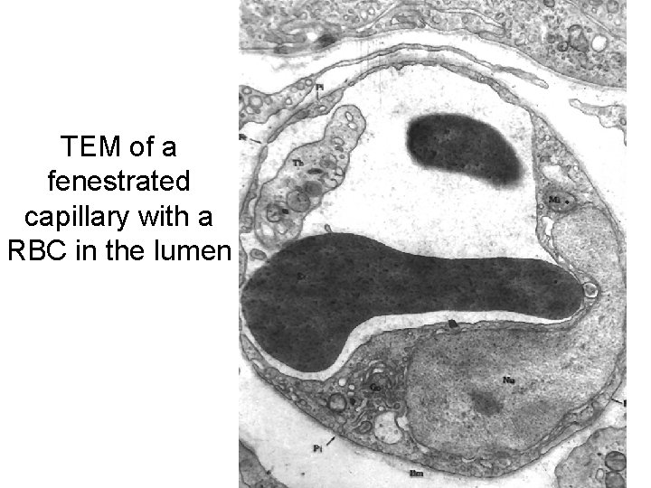 TEM of a fenestrated capillary with a RBC in the lumen 