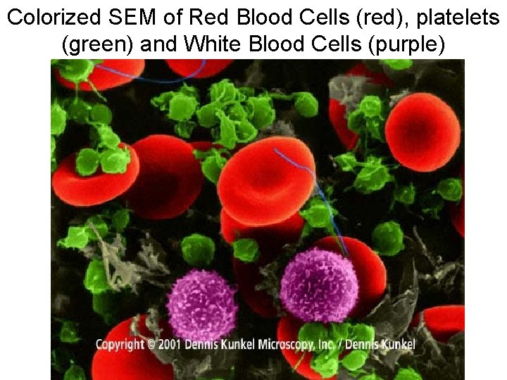 Colorized SEM of Red Blood Cells (red), platelets (green) and White Blood Cells (purple)