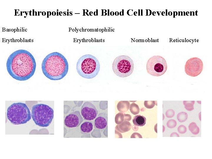 Erythropoiesis – Red Blood Cell Development Basophilic Erythroblasts Polychromatophilic Erythroblasts Normoblast Reticulocyte 