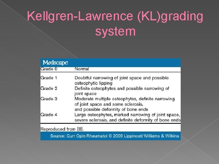 Kellgren-Lawrence (KL)grading system 