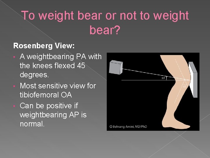 To weight bear or not to weight bear? Rosenberg View: • A weightbearing PA