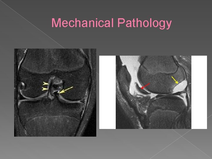 Mechanical Pathology 