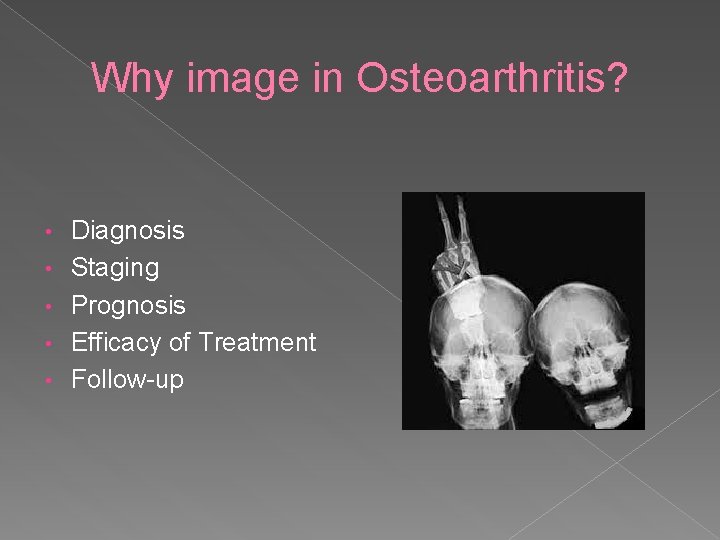 Why image in Osteoarthritis? • • • Diagnosis Staging Prognosis Efficacy of Treatment Follow-up