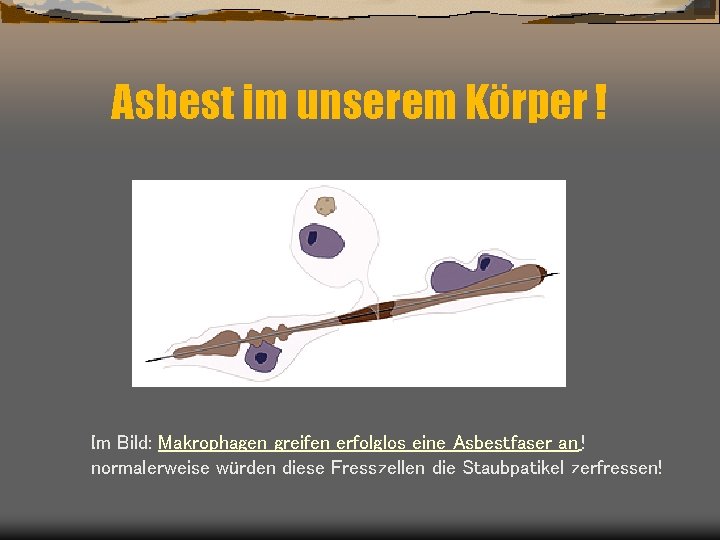 Asbest im unserem Körper ! Im Bild: Makrophagen greifen erfolglos eine Asbestfaser an !