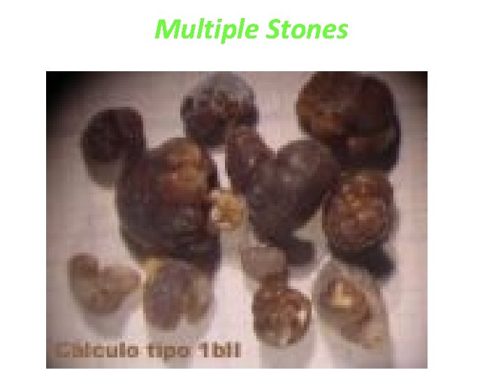 Multiple Stones 