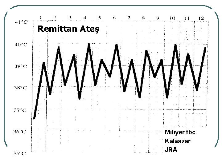 Remittan Ateş Miliyer tbc Kalaazar JRA 
