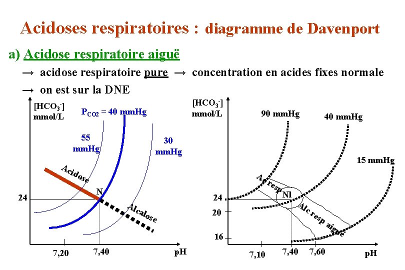 Acidoses respiratoires : diagramme de Davenport a) Acidose respiratoire aiguë → acidose respiratoire pure