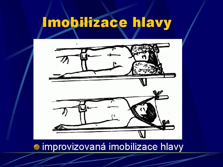 Imobilizace hlavy improvizovaná imobilizace hlavy 