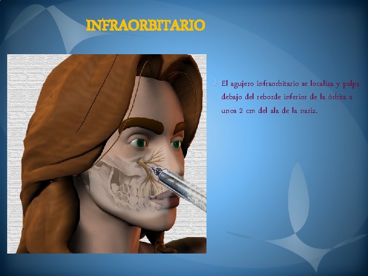 INFRAORBITARIO El agujero infraorbitario se localiza y palpa debajo del reborde inferior de la