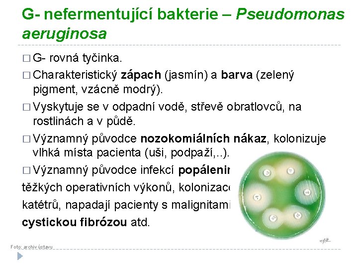 G- nefermentující bakterie – Pseudomonas aeruginosa � G- rovná tyčinka. � Charakteristický zápach (jasmín)