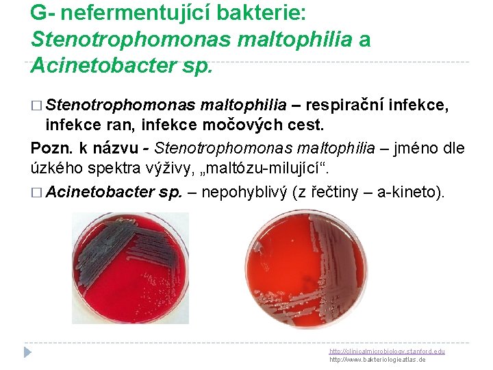 G- nefermentující bakterie: Stenotrophomonas maltophilia a Acinetobacter sp. � Stenotrophomonas maltophilia – respirační infekce,