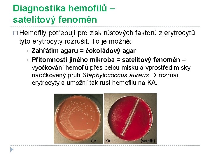 Diagnostika hemofilů – satelitový fenomén � Hemofily potřebují pro zisk růstových faktorů z erytrocytů