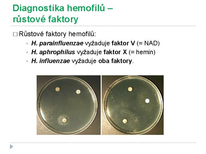 Diagnostika hemofilů – růstové faktory � Růstové faktory hemofilů: § § § H. parainfluenzae