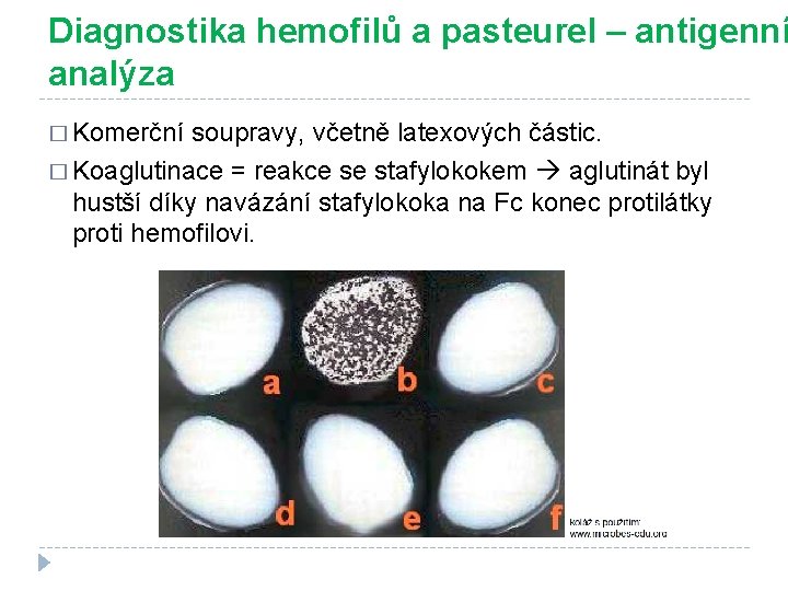 Diagnostika hemofilů a pasteurel – antigenní analýza � Komerční soupravy, včetně latexových částic. �