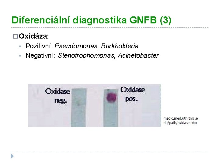 Diferenciální diagnostika GNFB (3) � Oxidáza: § § Pozitivní: Pseudomonas, Burkholderia Negativní: Stenotrophomonas, Acinetobacter