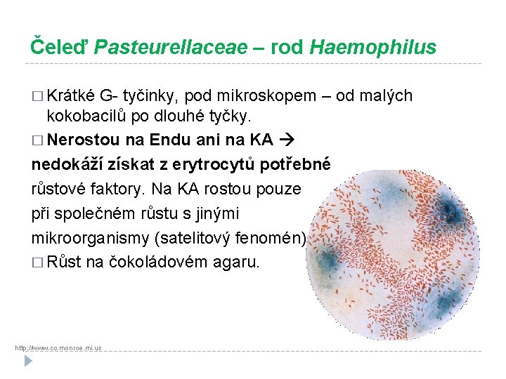 Čeleď Pasteurellaceae – rod Haemophilus � Krátké G- tyčinky, pod mikroskopem – od malých