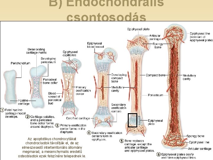 B) Endochondralis csontosodás Az apoptotikus chondrocytákat chondroclastok távolítják el, de az elmeszesedő interterritoriális állomány