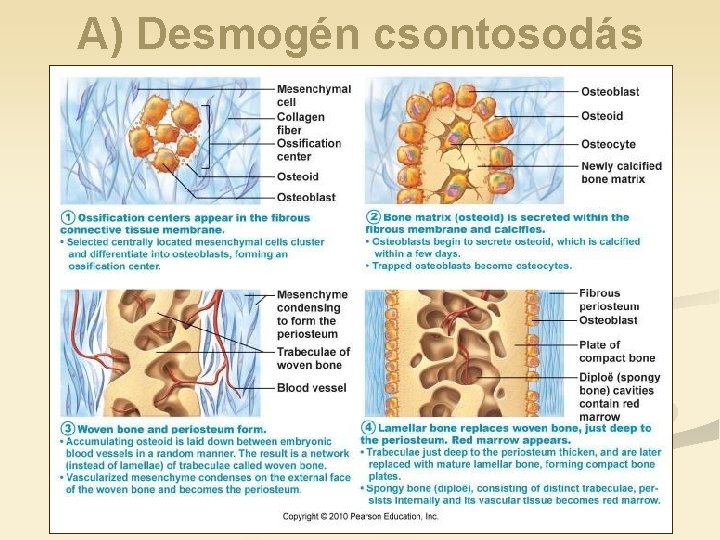 A) Desmogén csontosodás 