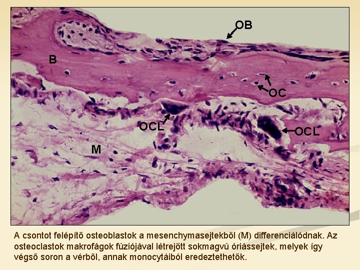 OB B OC OCL M A csontot felépítő osteoblastok a mesenchymasejtekből (M) differenciálódnak. Az