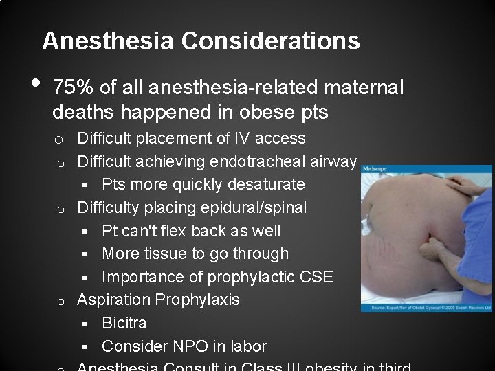 Anesthesia Considerations • 75% of all anesthesia-related maternal deaths happened in obese pts o