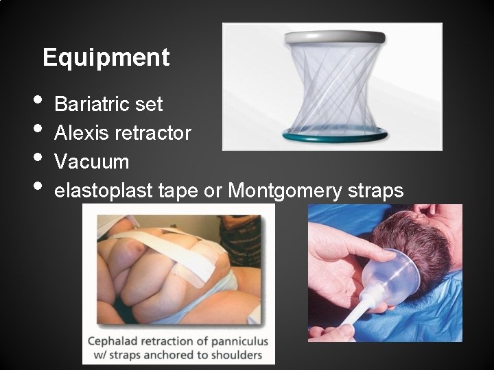 Equipment • • Bariatric set Alexis retractor Vacuum elastoplast tape or Montgomery straps 