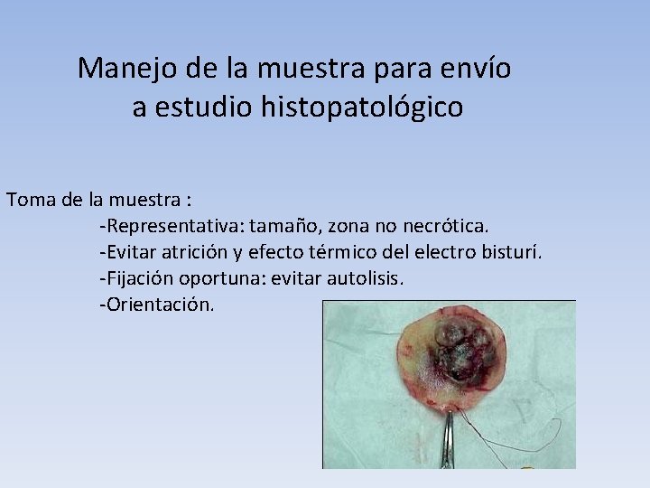 Manejo de la muestra para envío a estudio histopatológico Toma de la muestra :