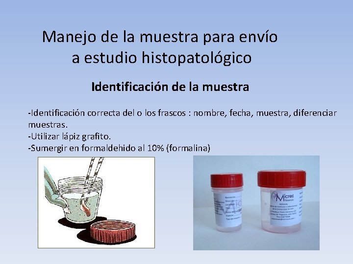 Manejo de la muestra para envío a estudio histopatológico Identificación de la muestra -Identificación