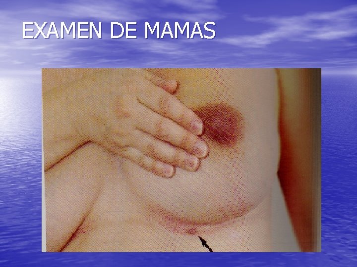 EXAMEN DE MAMAS 