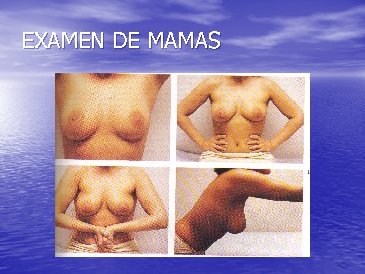 EXAMEN DE MAMAS 