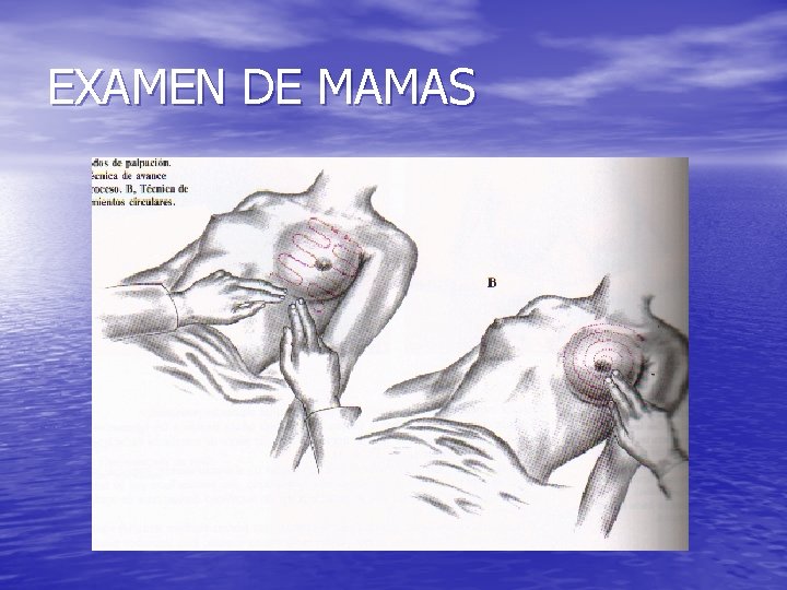 EXAMEN DE MAMAS 