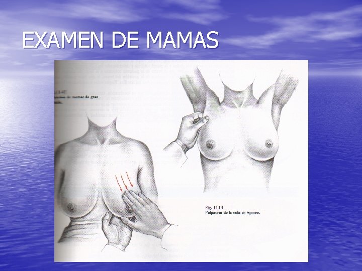 EXAMEN DE MAMAS 