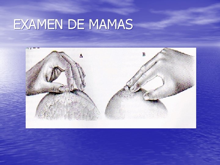 EXAMEN DE MAMAS 