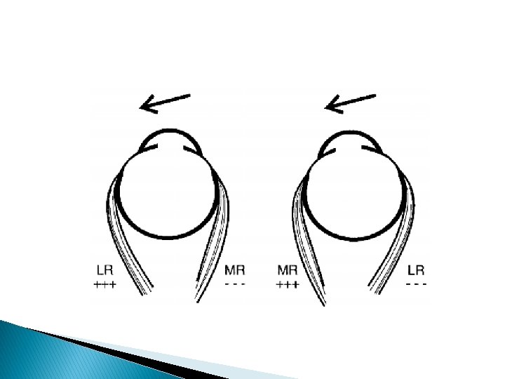 Strabismus The art of harmony Extraocular muscles Remember