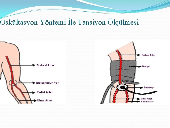 Oskültasyon Yöntemi İle Tansiyon Ölçülmesi 