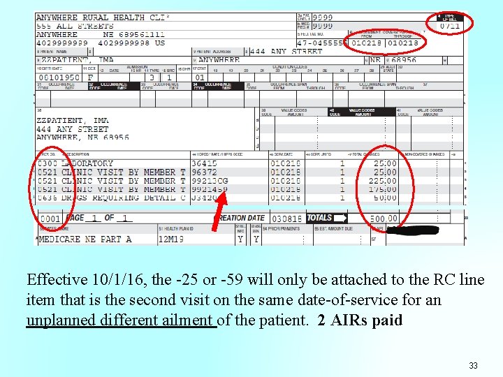 Effective 10/1/16, the -25 or -59 will only be attached to the RC line