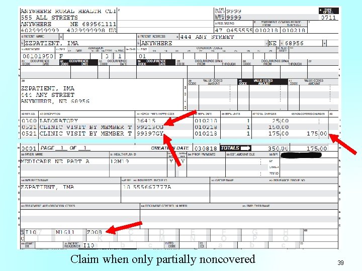 Claim when only partially noncovered 39 