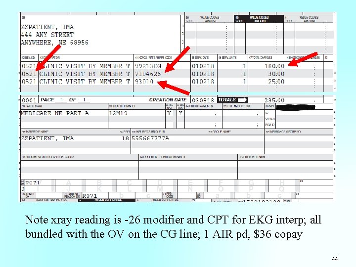 Note xray reading is -26 modifier and CPT for EKG interp; all bundled with