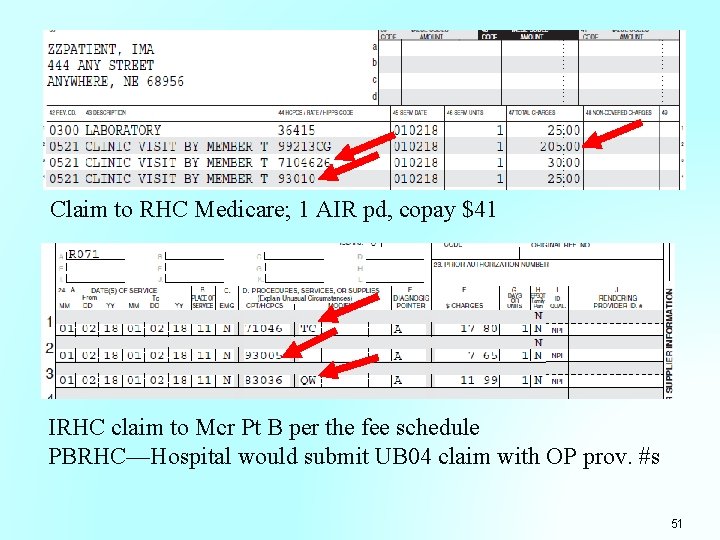 Claim to RHC Medicare; 1 AIR pd, copay $41 IRHC claim to Mcr Pt