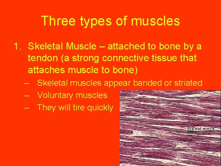 Three types of muscles 1. Skeletal Muscle – attached to bone by a tendon
