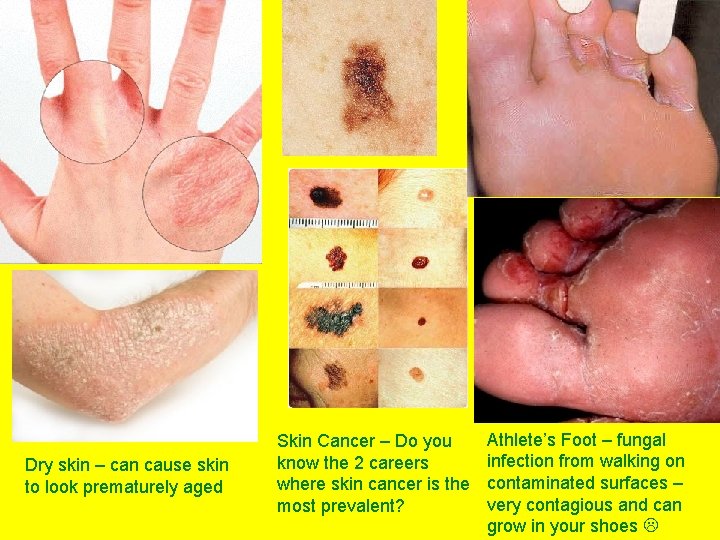 Dry skin – can cause skin to look prematurely aged Skin Cancer – Do