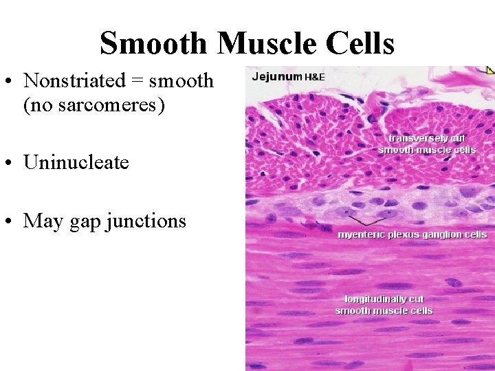 Smooth Muscle Cells • Nonstriated = smooth (no sarcomeres) • Uninucleate • May gap Smooth Muscle Cells • Nonstriated = smooth (no sarcomeres) • Uninucleate • May gap