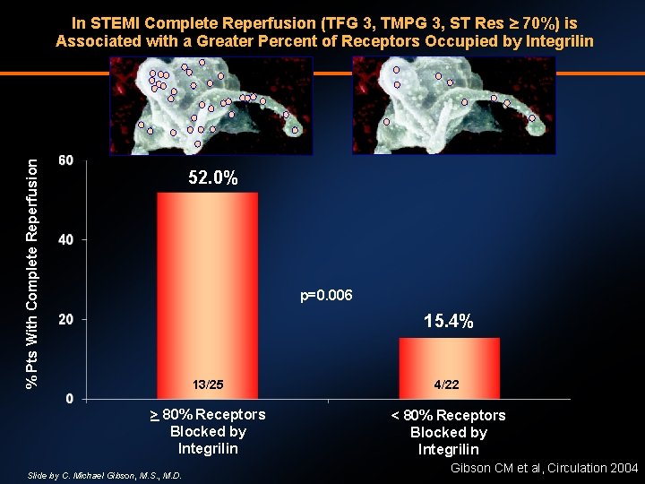 % Pts With Complete Reperfusion In STEMI Complete Reperfusion (TFG 3, TMPG 3, ST